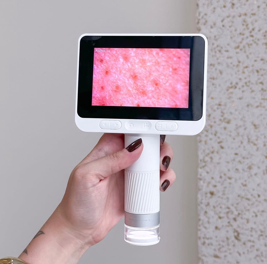 DERMATOSCÓPIO DIGITAL M2C 4.0" 8GB